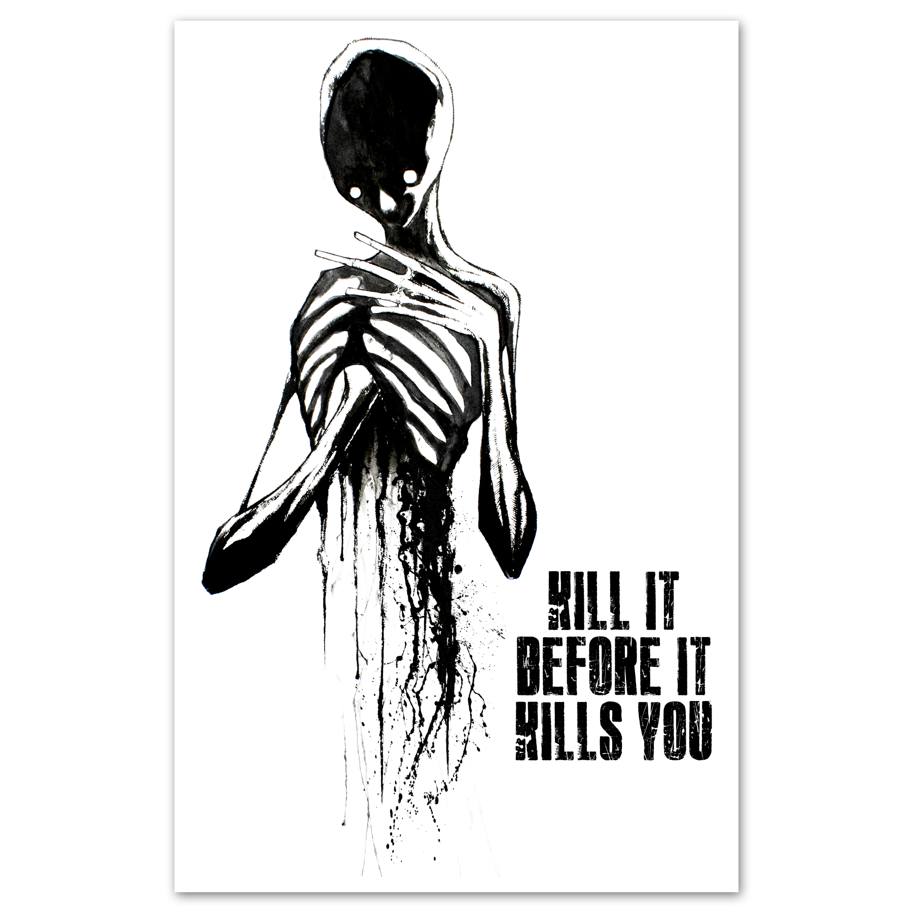 Kill It Before It Kills You Print
